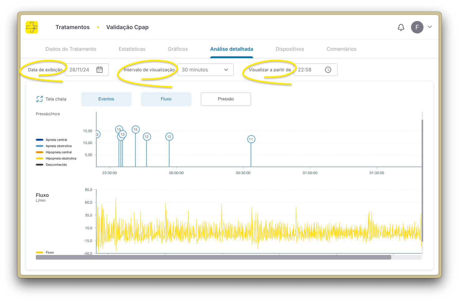 Filtros de gráficos do tratamento